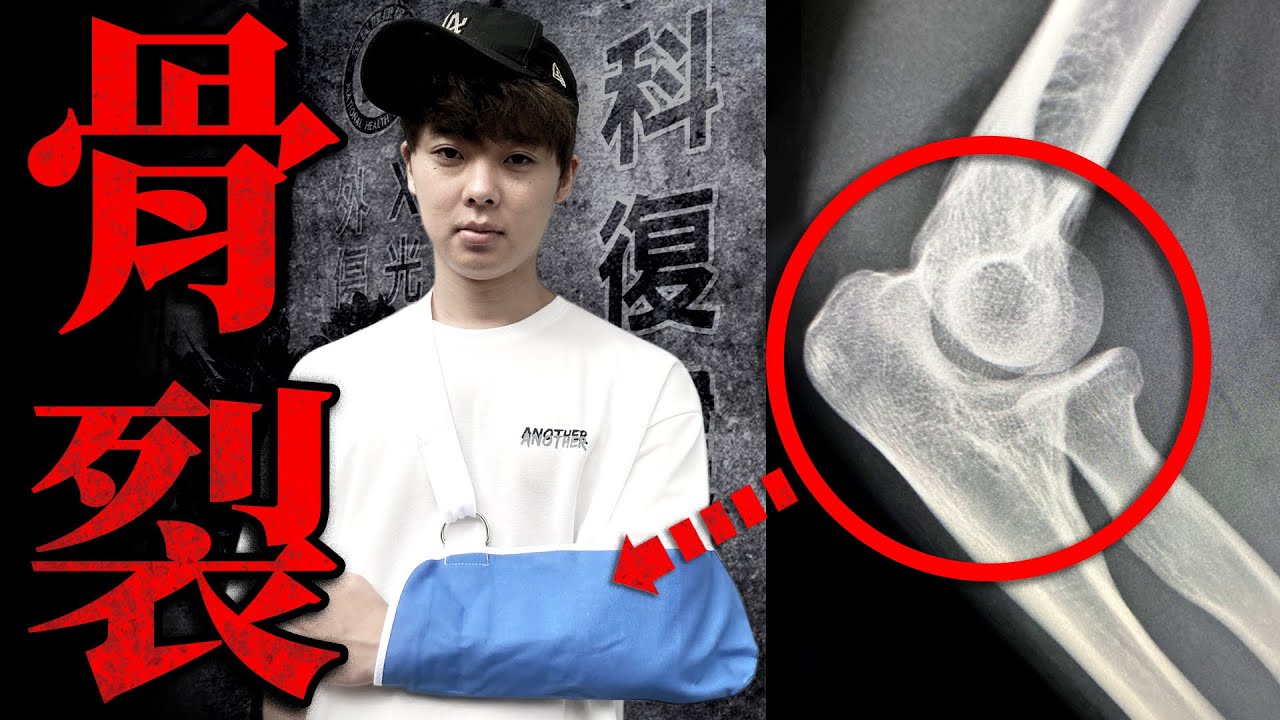 【緊急速報】三原的左手肘受傷了。