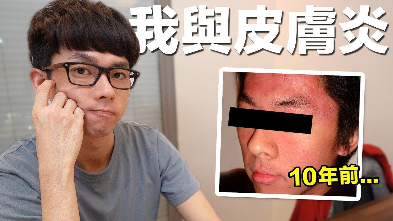 阿滴英文｜令人心碎的分享… 阿滴的異位性皮膚炎故事 (中英雙字幕)